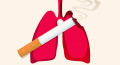 COPD: a fojtogató népbetegség