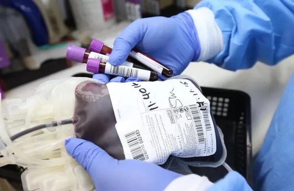 Plazmaadás: életmentő támogatás